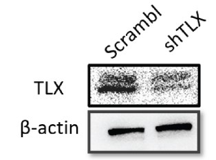 Protein expression of TLX in A1235-scramble and shTLX by Western blot.jpg